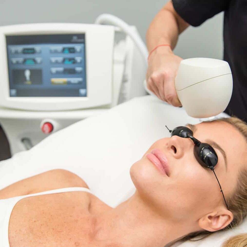 IPL Skin Rejuvenation