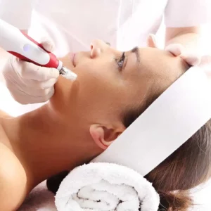 Vampire Facial. Course of 3